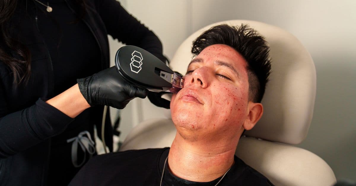 25 Brands Own 95% of AI Citations in Aesthetic Medicine